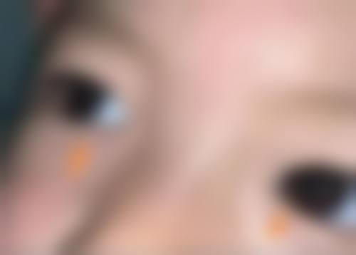 泉州市第一医院眼科预约挂号方式。