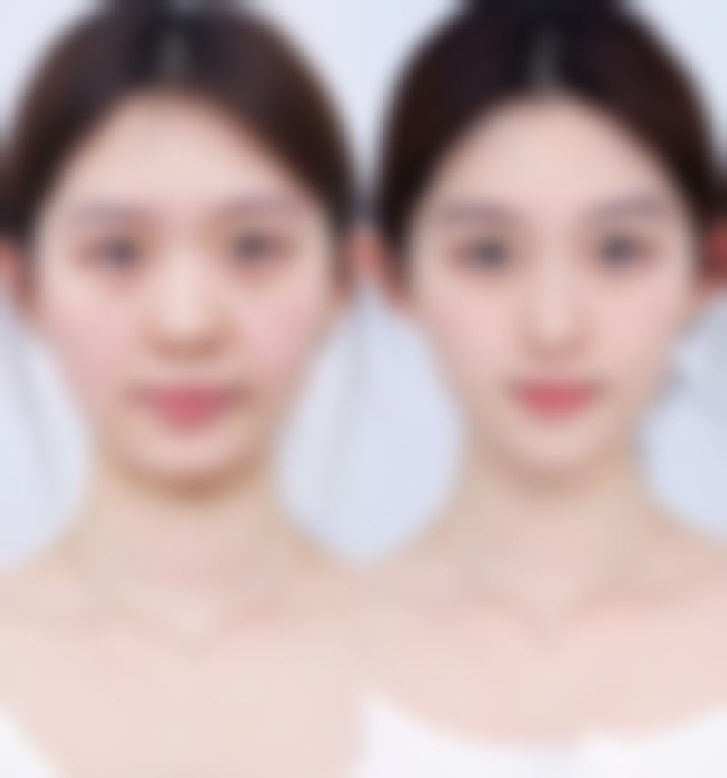 衢州物产凤凰医院医美中 心预约挂号方式。