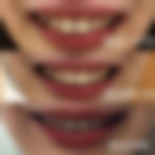 浙江金华东阳有松口腔擅长项目。