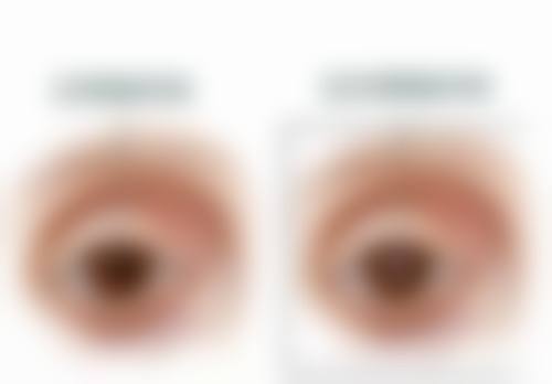 马鞍山十七冶医院眼科简介