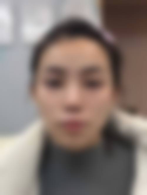 西安新长安国内外妇产医院整形美容科医生团队经验稳定。