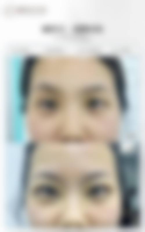 杭州浙美医疗美容门诊部治疗反馈与口碑评价。