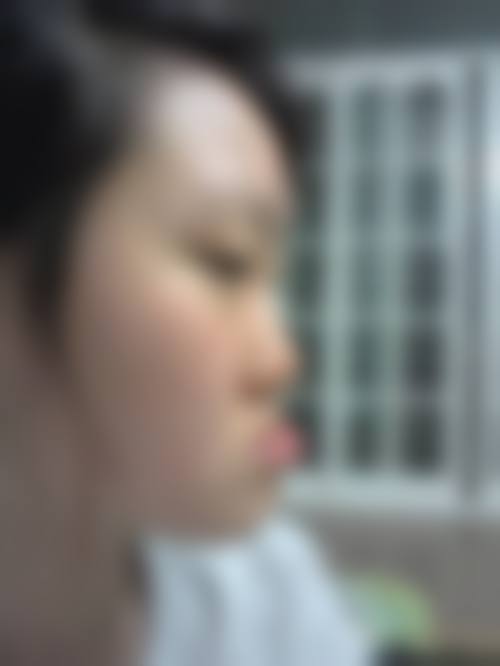 山西长治众雅口腔擅长项目。