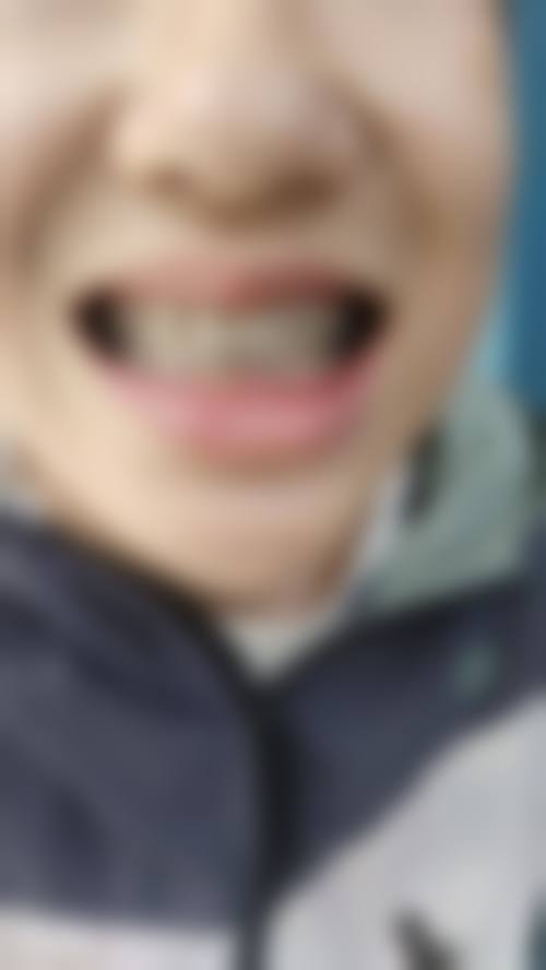 濮阳雅美口腔诊所擅长项目