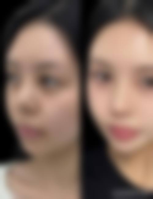 西安新长安国内外妇产医院整形美容科治疗反馈与口碑评价。
