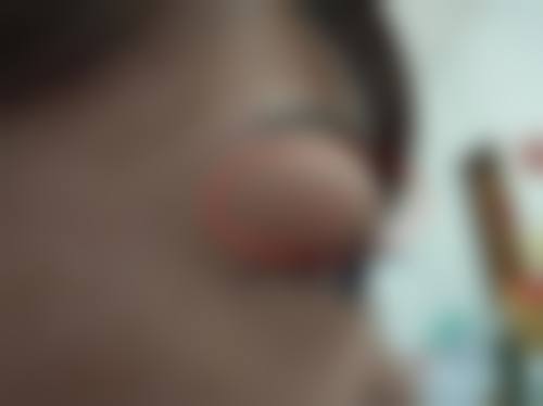 临沂凯旋医院眼科擅长项目。
