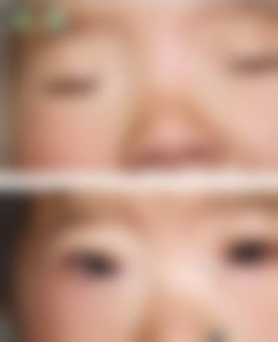 辽宁抚顺海睿眼视光有限公司擅长项目。