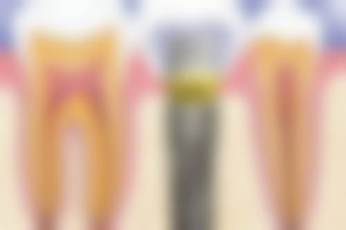 杭州禾木口腔门诊部口碑评价