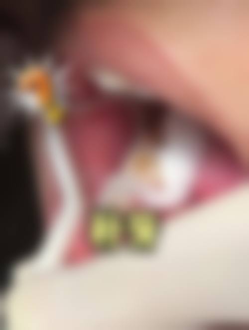 李秋实医生的技术实力