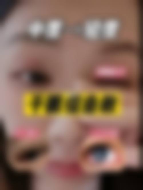 平南爱尔眼科医院门诊营业时间。