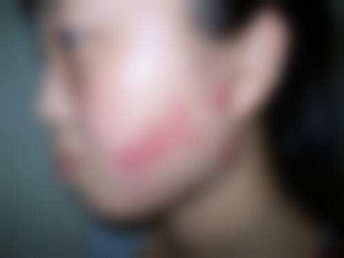 抚顺何英杰医疗美容诊所项目优势