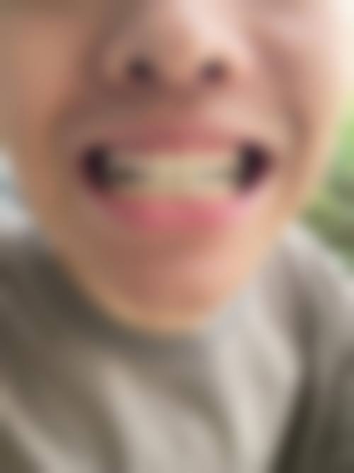 合肥美奥口腔预约挂号方式