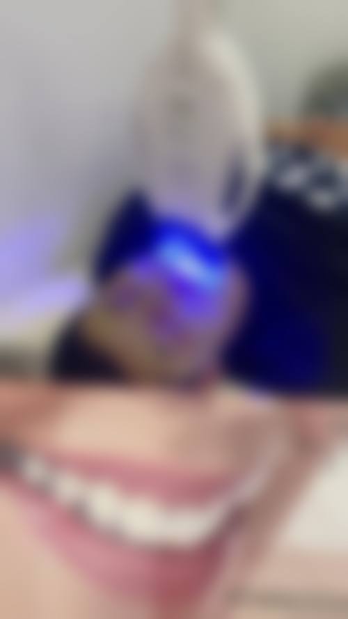 山西吕梁孝义安雯齿科擅长项目。