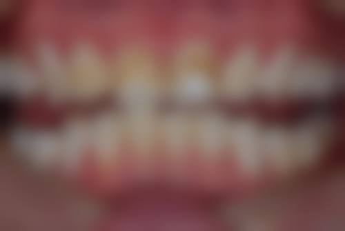 重庆德贝口腔诊所治疗反馈与口碑评价。