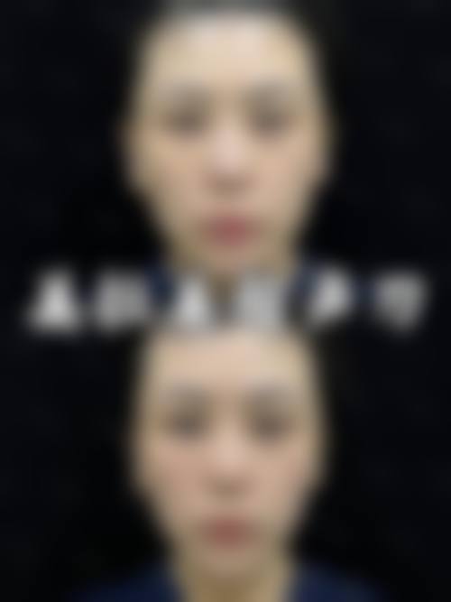 台中亞欣醫美整形診所预约挂号方式。