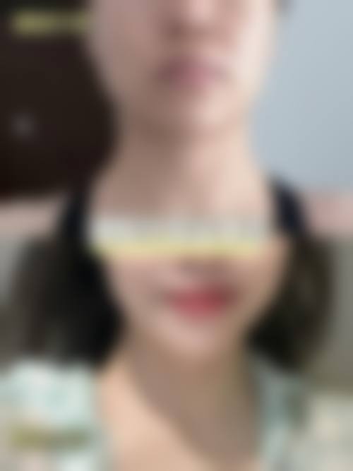 开封星颜医疗美容整形医院预约挂号方式。