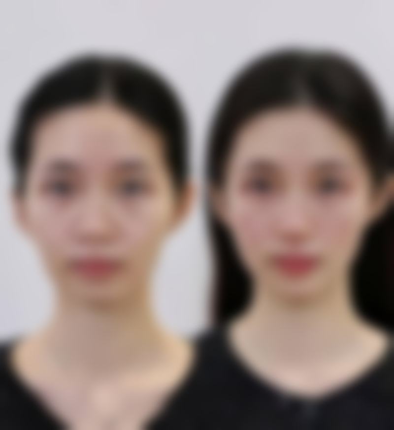 武汉斯启诺医疗美容门诊部热玛吉能带来什么成效呢？