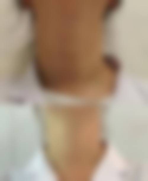 大连李达医疗美容诊所治疗反馈与口碑评价。