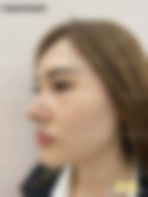 武汉伊美馨整形美容医院医生团队经验稳定。