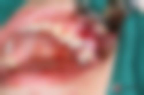 温州老年病医院口腔科预约挂号方式。