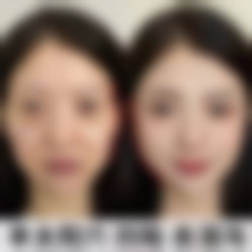 昆明美诚均美医疗美容诊所擅长项目。