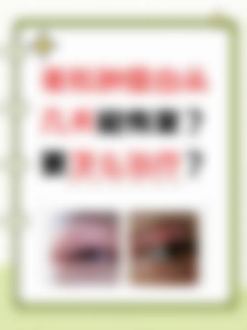 赤峰宝山医院眼科医生团队经验稳定。