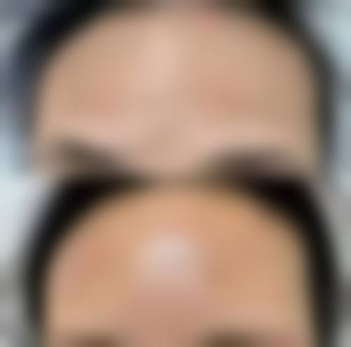 青岛大学医学校松山医院医疗美容科治疗反馈与口碑评价。