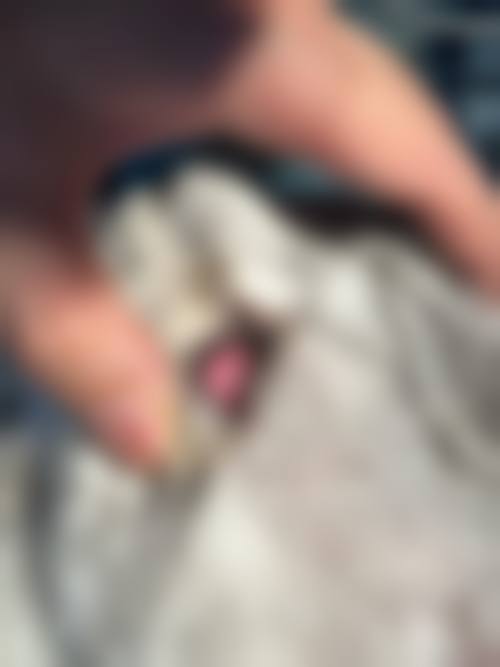 呼伦贝尔市人民医院眼科地理位置便于到院。