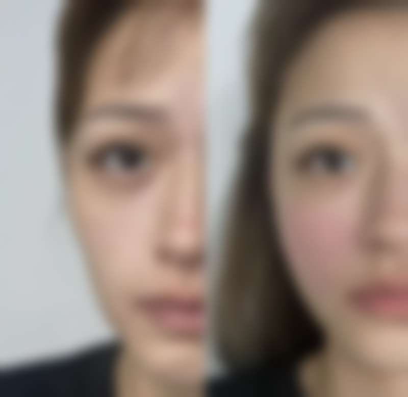 河南婵馨悦医疗美容门诊部2026年价格收费表：