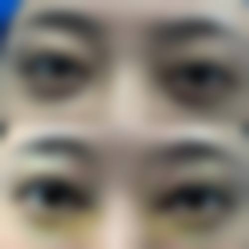 阜阳市第六人民医院眼科擅长项目。