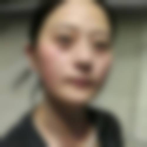 贵州贵阳美目眼科医院门诊营业时间。