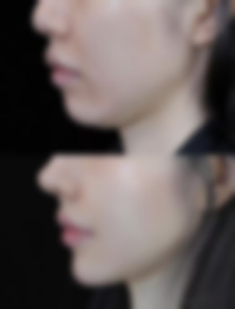 青岛市立医院西院烧伤整形科正规吗?