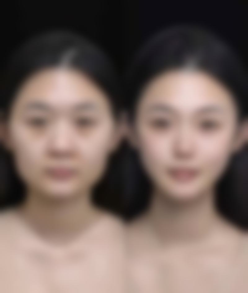 武汉斯启诺医疗美容门诊部董雷:个性化定制的手术方案