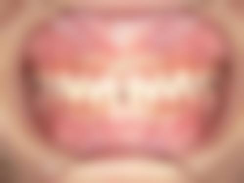 北海牙博士口腔门诊部项目价格