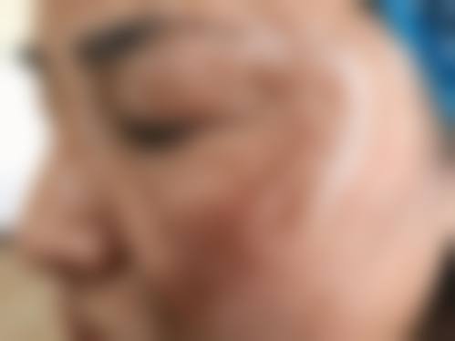 武汉黄陂区中医医院皮肤科医生团队经验稳定。