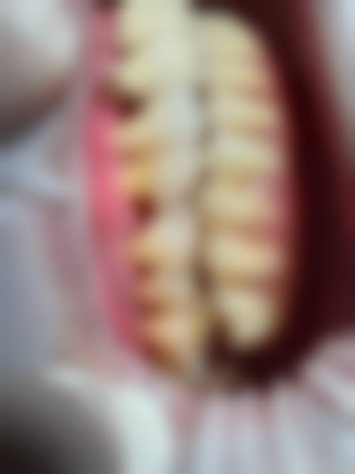 预约优惠活动