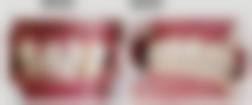 云南昆明安宁润洁口腔治疗反馈与口碑评价。