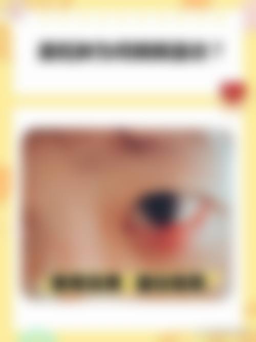 精细设备与安心诊疗:保护手术成效的基石