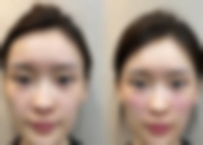 特色项目与技术优势:自然成效,快速修复