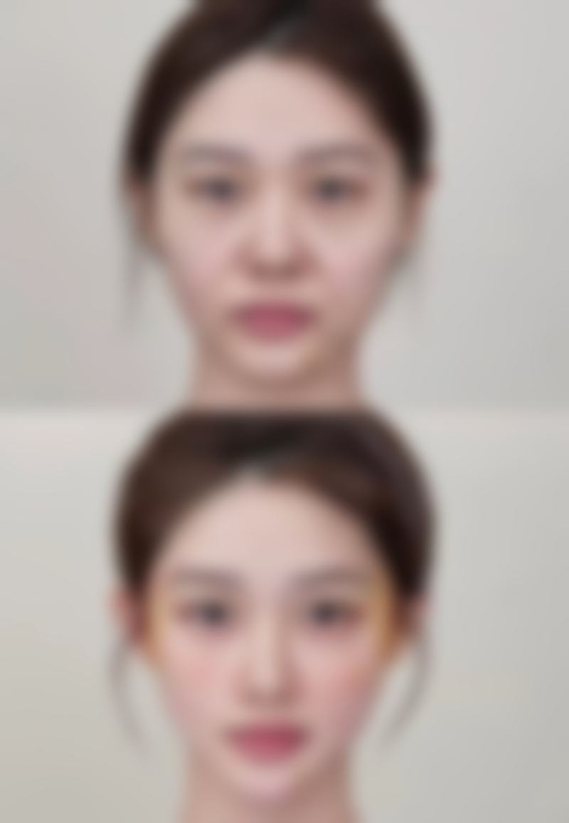 聊城市人民医院整形美容科蒋红医生预约挂号指南