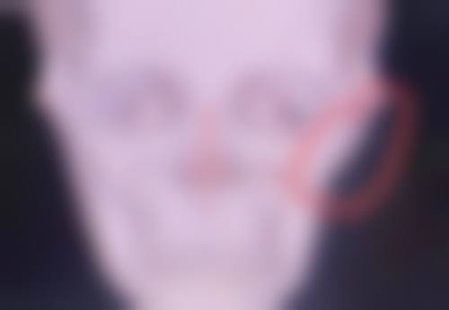 延边大学附属医院整形美容科正规吗?