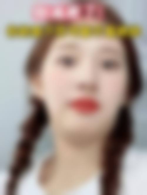 南昌美伊尔医疗美容门诊部治疗反馈与口碑评价。