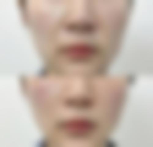 绛县瓣美琪整形医院擅长项目。