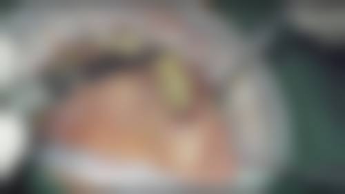 漳州德益口腔(矫正·种植·治疗中 心)治疗反馈与口碑评价。