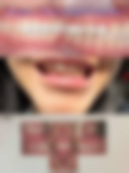 洛阳市涧西区珠江路第二社区卫生服务中 心擅长项目。