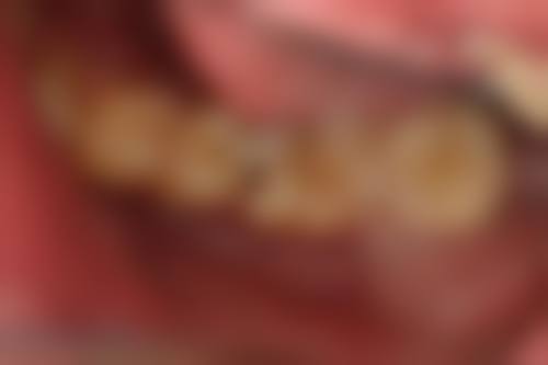 山东临沂罗庄益宏口腔诊所地理位置便于到院。