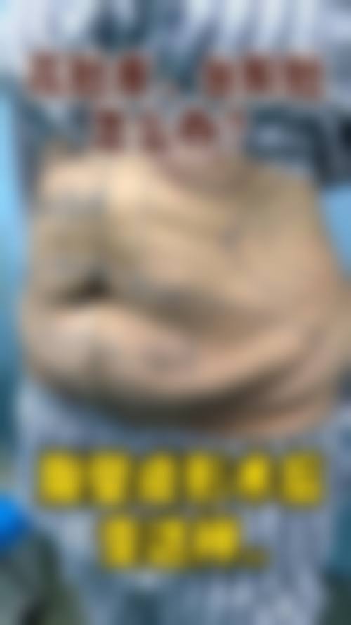 擅长项目详解:谢娟医美项目精讲