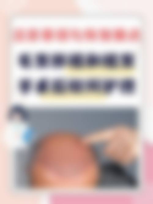 常见问题解答(FAQ)