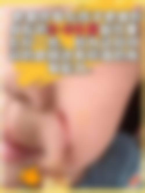 威海华僖医疗美容诊所治疗反馈与口碑评价。