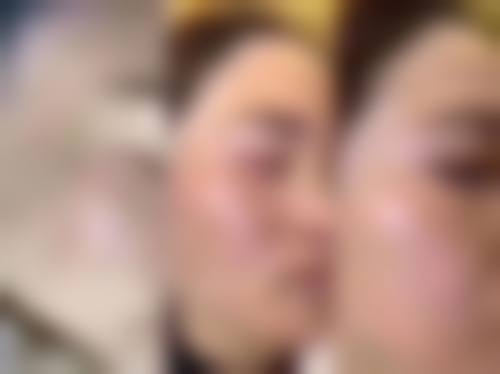 临床实例分享:谢娟医生真实实例解析